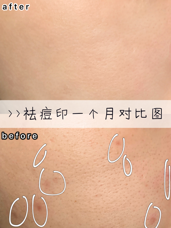 烟酰胺 —— 颖哥