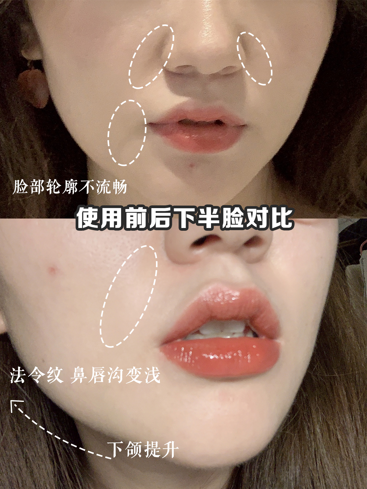 4D胶原蛋白雕塑精华 —— LL