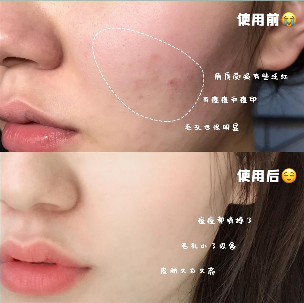 烟酰胺 —— LL