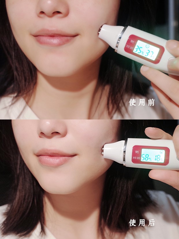 原液 —— 赖皮儿