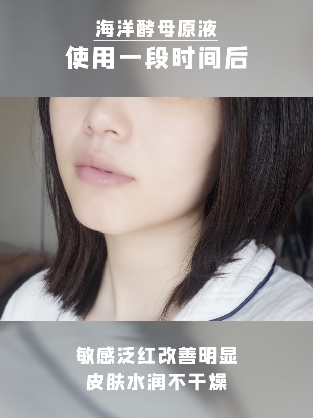 原液 —— 赖皮儿